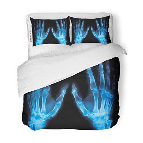 Radiography X Ray Of Both Human Hands Ailing Decorative Bedding Set